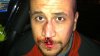 zimmerman_wounds2.jpg