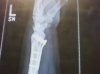 arm2.jpg