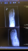 B56EA406-0455-4770-864D-E67550690393.png